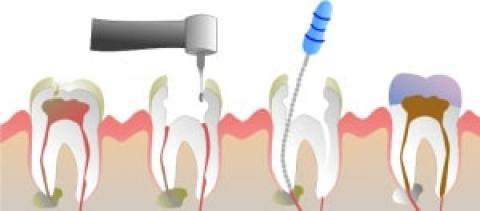 Endodontics