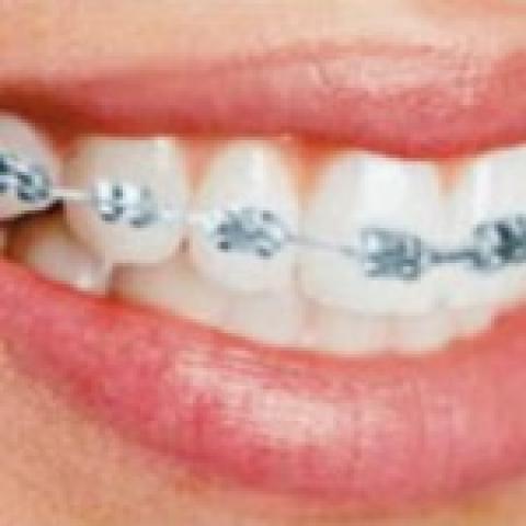 Orthodontic Dentistry