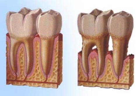 Periodontology