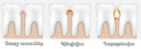 Periodontology